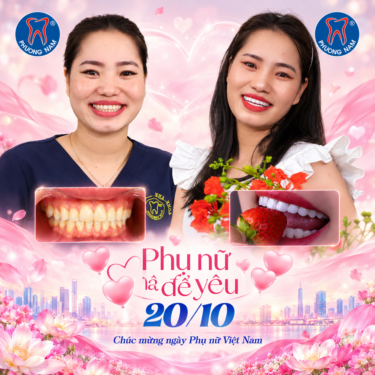 Hình ảnh trước và sau làm răng sứ thẩm mỹ của chị Giang Nhung tại Nha Khoa Phương Nam